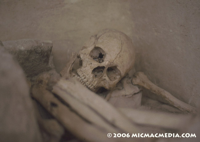 Nugget #42 Skeleton in repose ID 8001 Nugget #42 Skeleton in repose ID 8001